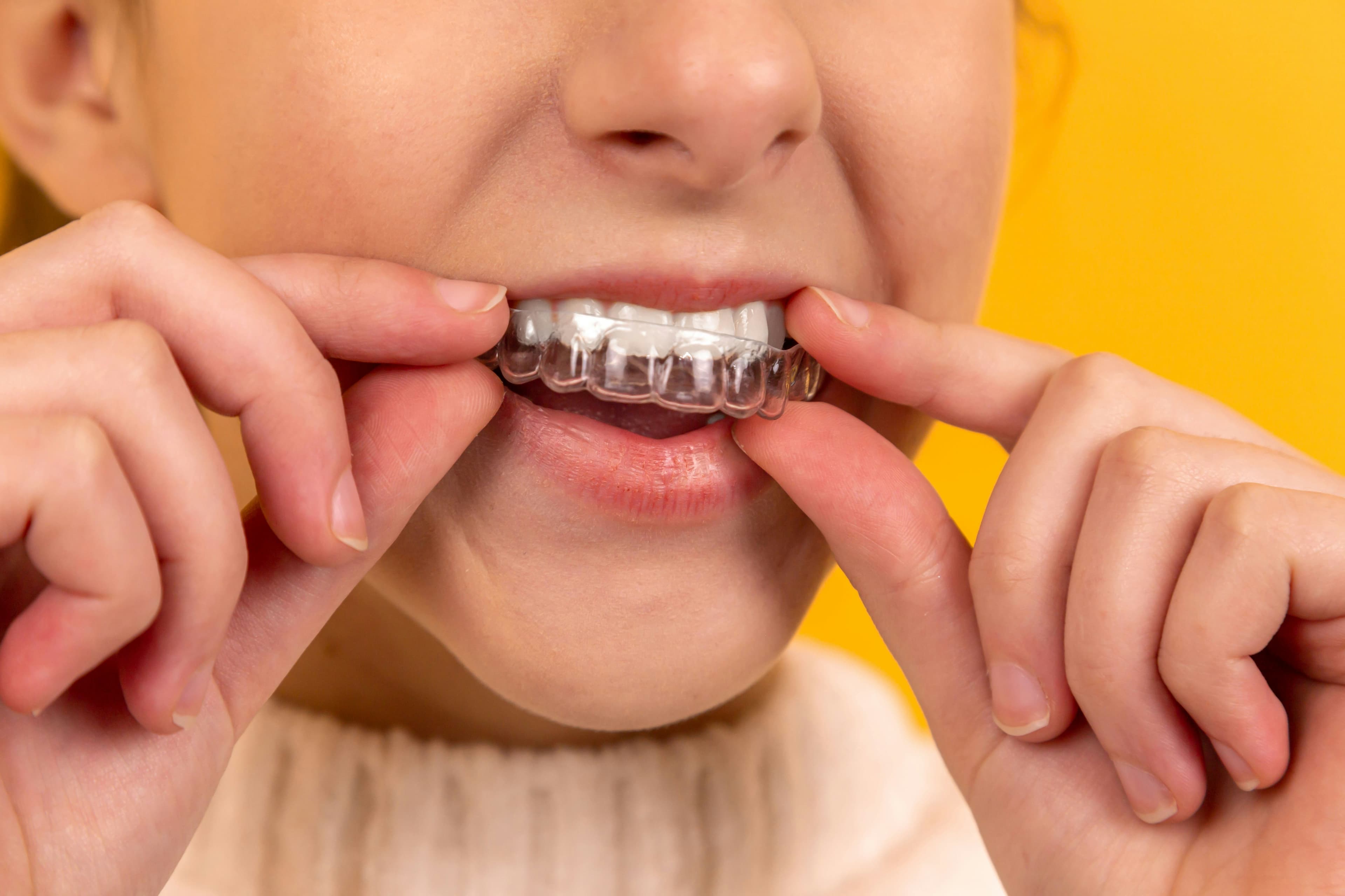 Dental Insurance